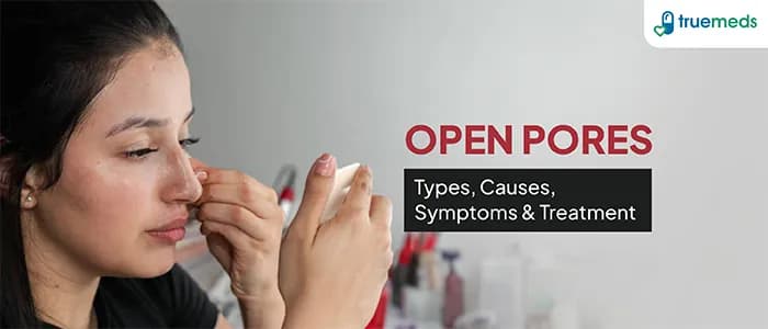 Open Pore Types, Causes, Prevention &amp; Treatment